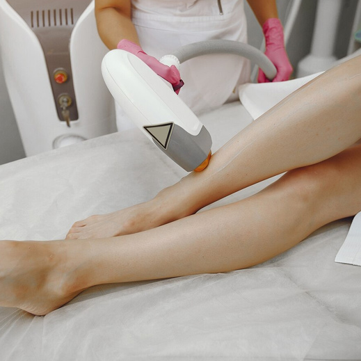 laser-hair-removal